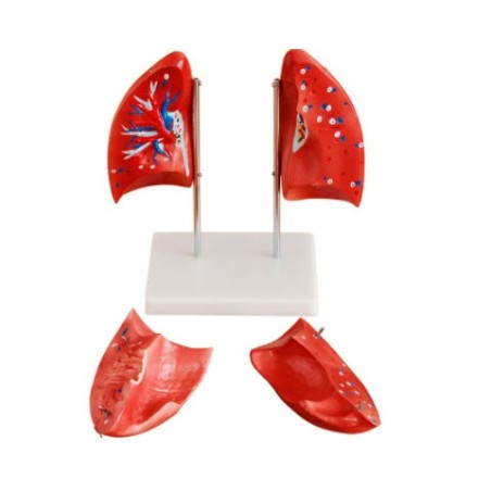 MODELO ANATOMICO PULMON 4PARTES MEXS-321
