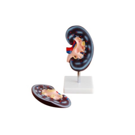MODELO ANATOMICO RIÑON 2 PARTES MEXS-310-2