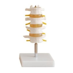 MODELO LUMBAR 4 PIEZAS MEXS-118