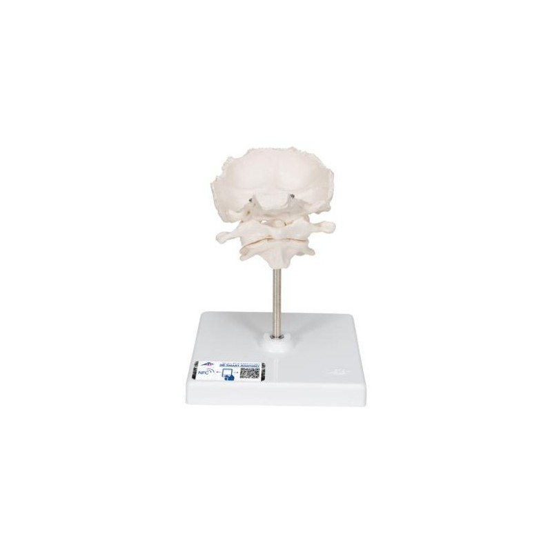 MODELO ATLAS, AXIS Y HUESO OCCIPITAL  A71