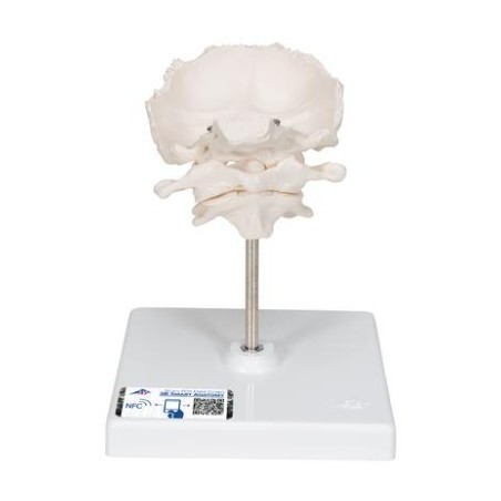 MODELO ATLAS, AXIS Y HUESO OCCIPITAL  A71