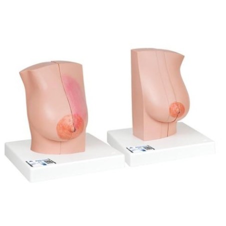 MODELO GLÁNDULA MAMARIA EN LACTANCIA + GLÁNDULA MAMARIA NORMAL -L56