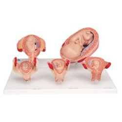 MODELO DE EMBARAZO L11/9