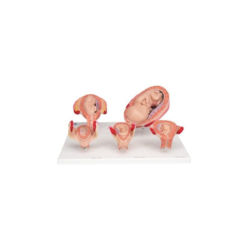 MODELO DE EMBARAZO L11/9