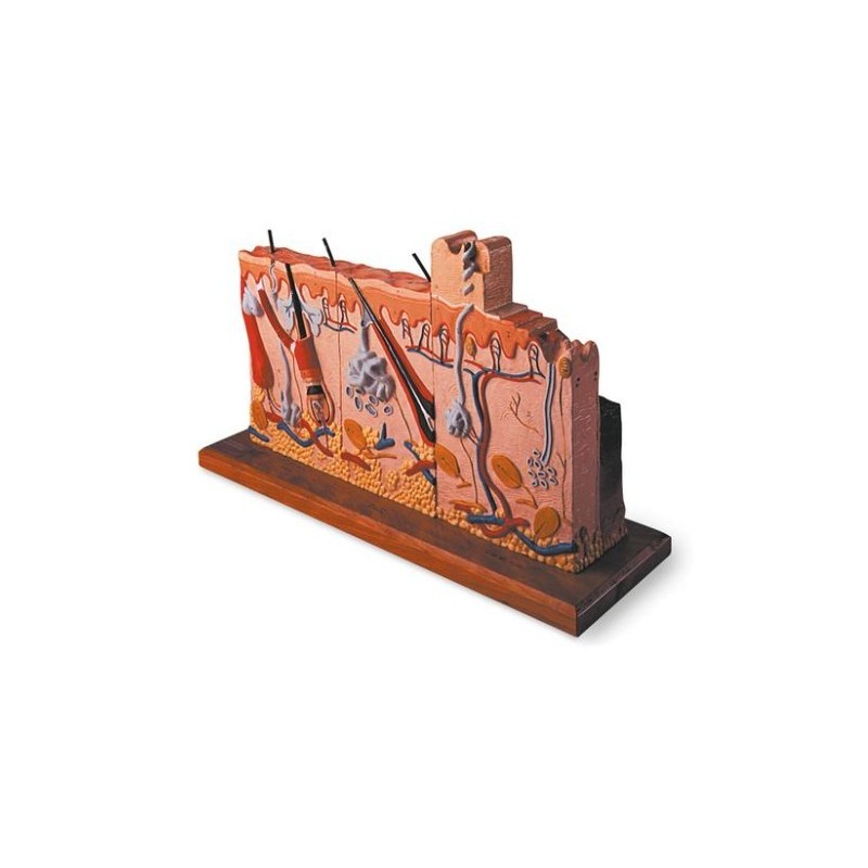 MODELOS PATOLOGÍAS DE LA PIEL  W42533