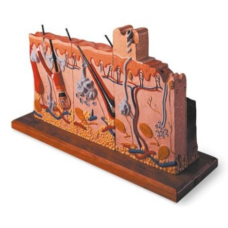 MODELOS PATOLOGÍAS DE LA PIEL  W42533