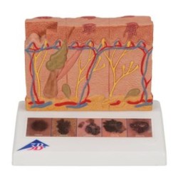 MODELOS PATOLOGÍAS DE LA PIEL J15