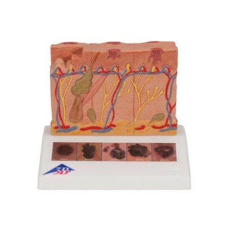 MODELOS PATOLOGÍAS DE LA PIEL J15