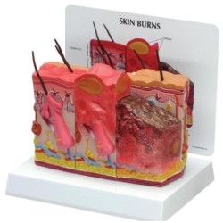 MODELOS PIEL QUEMADA W33372