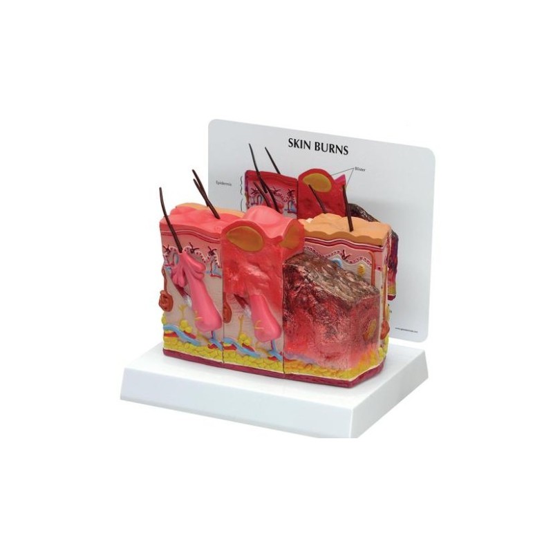 MODELOS PIEL QUEMADA W33372