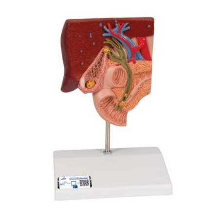 MODELO DE CALCULO BILIAR