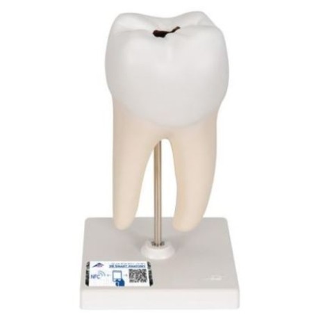 MODELO MOLAR INFERIOR CON 2 RAÍCES